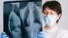 The Cancer Paradox: Why Middle Age Is the Danger Zone